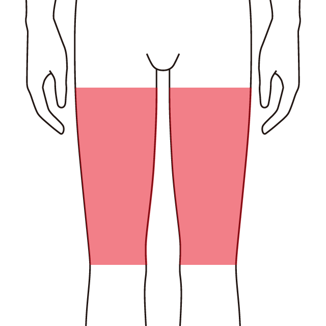 両ひざ上脱毛