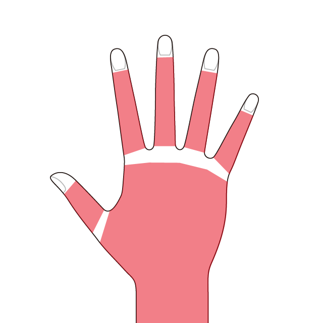 両手の甲・指脱毛