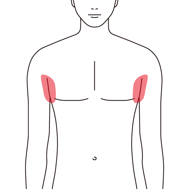 両ワキ脱毛